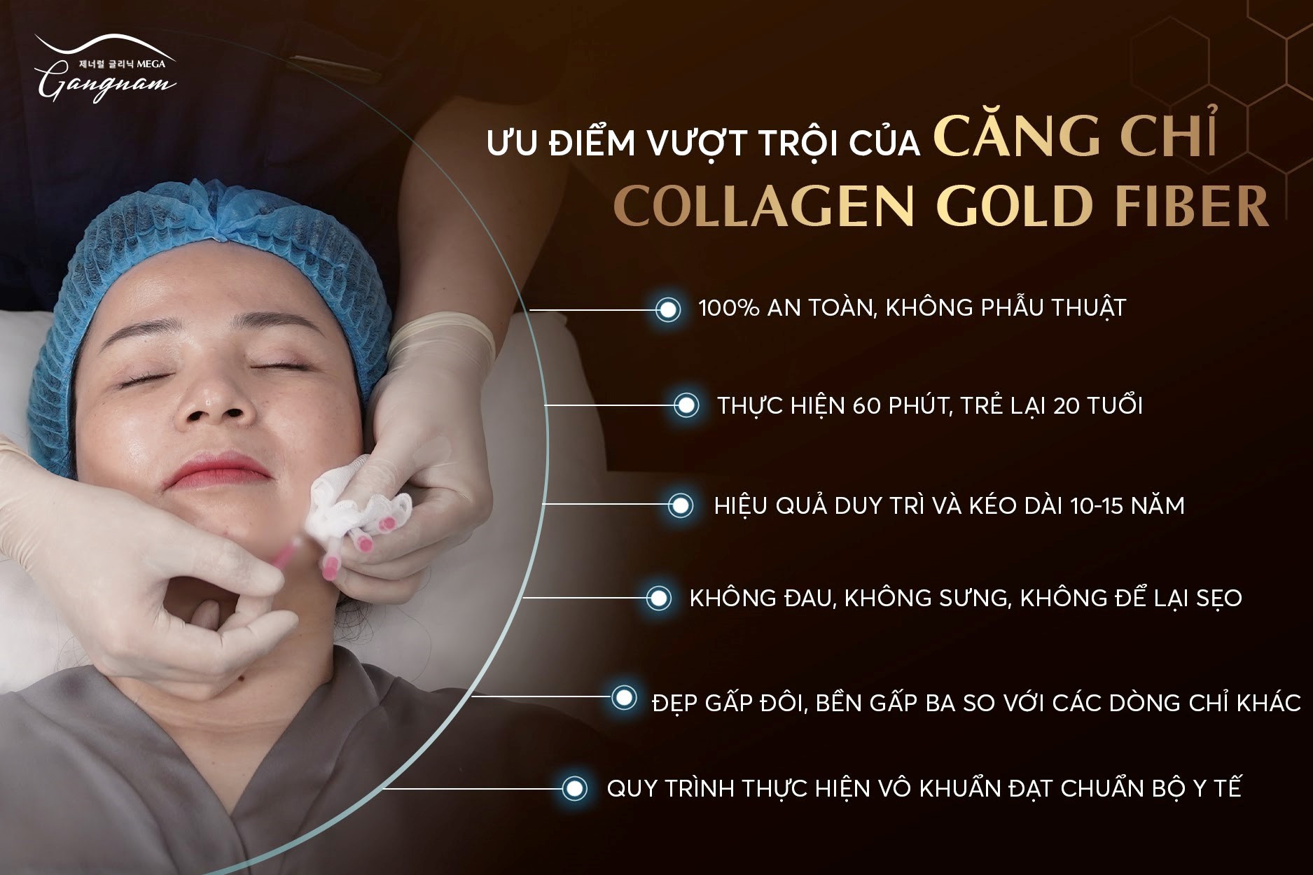 Ưu điểm vượt trội của căng chỉ Collagen Gold Fiber so với các phương pháp trẻ hóa trên thị trường 