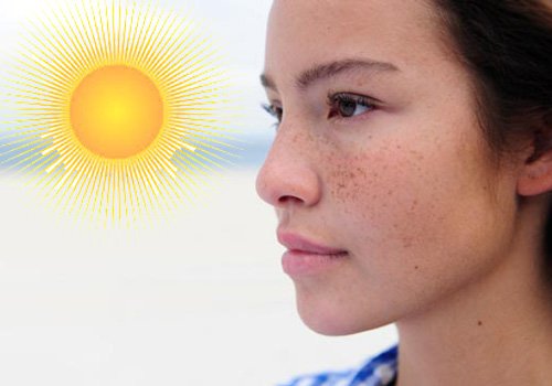 Tác động từ ánh nắng mặt trời cực kỳ có hại cho da, nguyên nhân chính gây ra nám