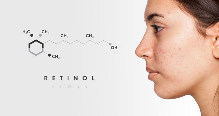 Retinol là một hoạt chất được tin dùng trong việc điều trị các bệnh lý sắc tố da