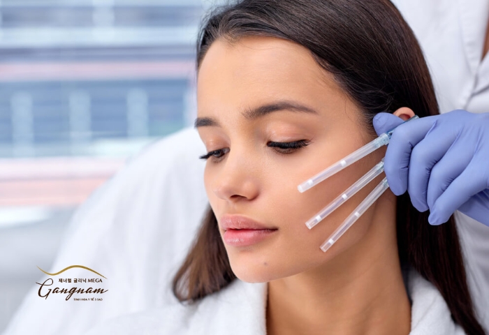 Hiệu quả căng chỉ da mặt giữ được bao lâu phụ thuộc chủ yếu vào thành phần sợi chỉ