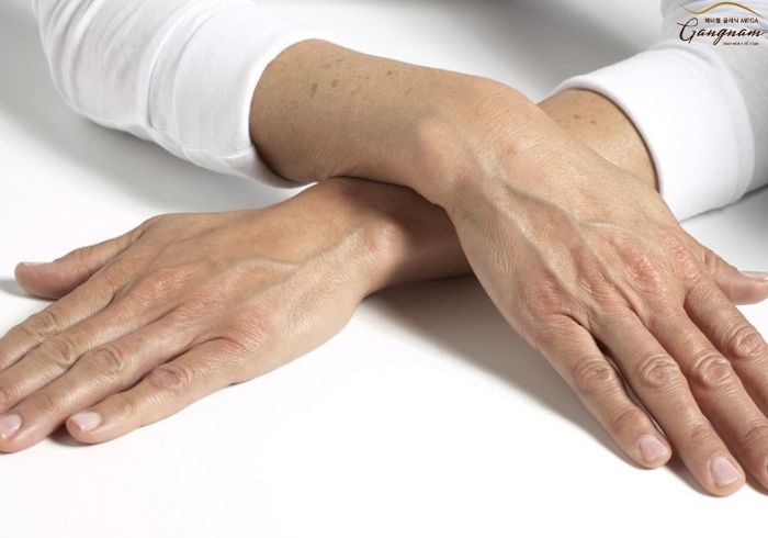 Dấu hiệu nhận biết da tay bị lão hóa sớm