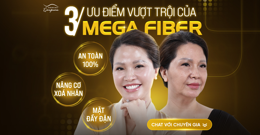 Ưu điểm vượt trội trong việc xóa nhăn định hình gương mặt trẻ trung của Mega Fiber 