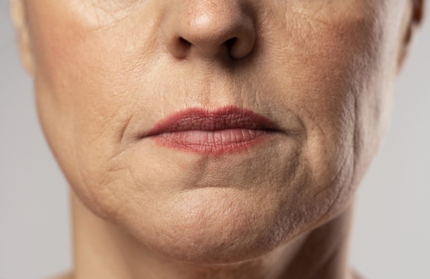 Các biểu hiện của tuổi tác với nếp nhăn là khi bạn cần can thiệp trẻ hóa làn da 