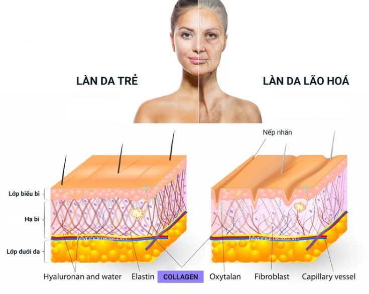 Collagen cải thiện cấu trúc bên trong da và cơ thể góp phần duy trì sức khỏe và sắc đẹp lâu dài hơn