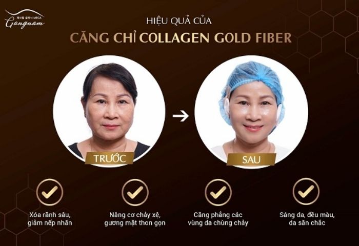Cách bổ sung collagen bằng phương pháp chuyên sâu
