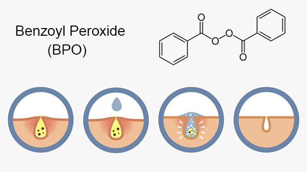Tretinoin không nên dùng với Benzoyl Peroxide