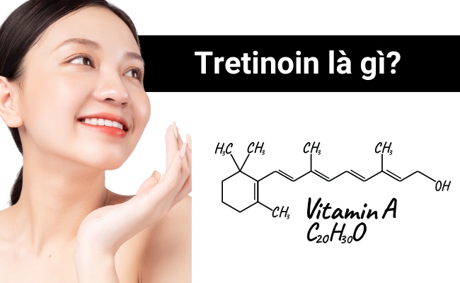 Tretinoin là hoạt chất gì? 
