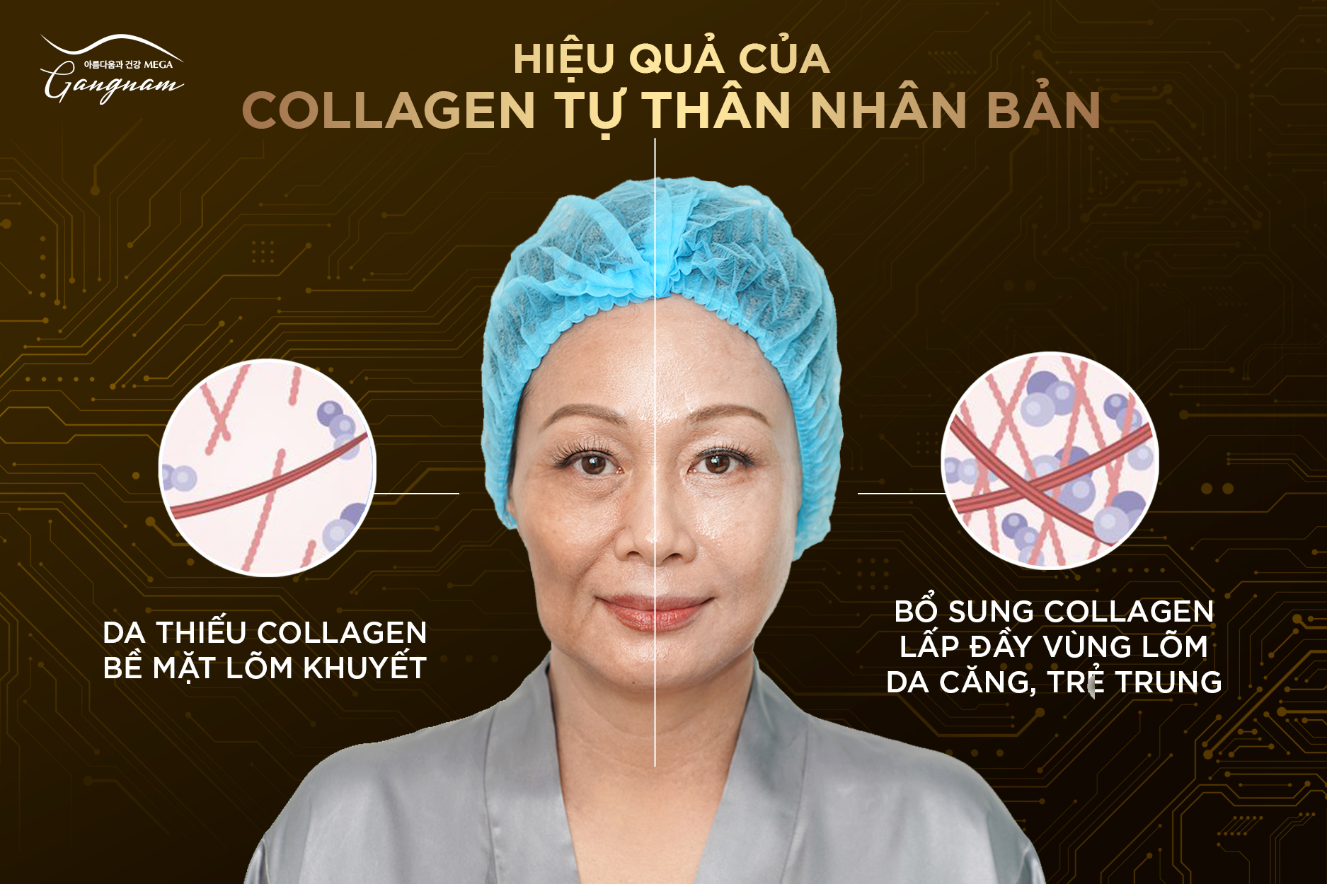 Collagen tự thân nhân bản xứng đáng là giải pháp an toàn bổ sung collagen trực tiếp cho làn da
